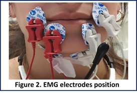 figure 2: emg electrodes position