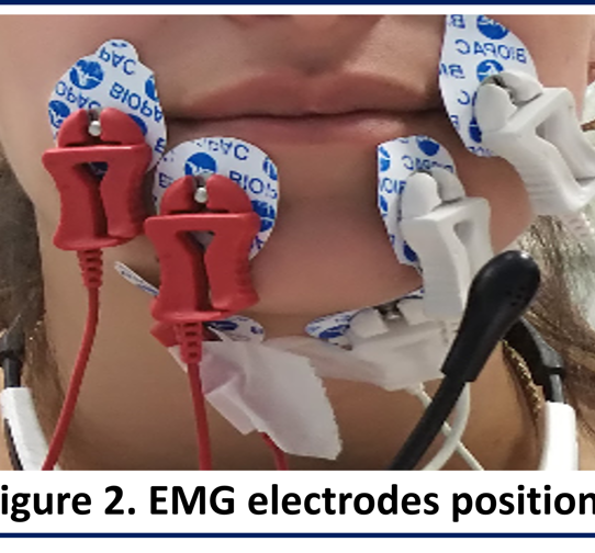 figure 2: emg electrodes position